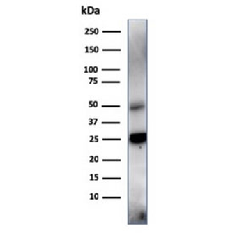 TIM-3 Antibody / HAVCR2