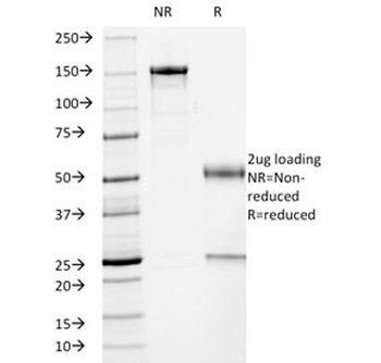 p53 Antibody / TP53