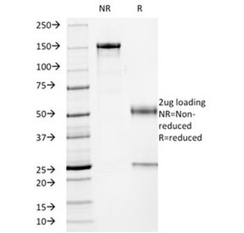 p53 Antibody / TP53