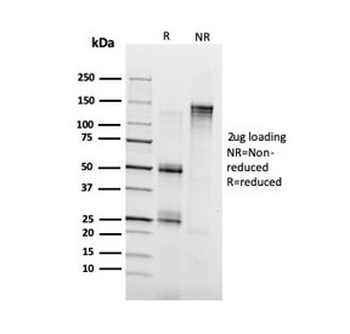 Annexin A1 Antibody