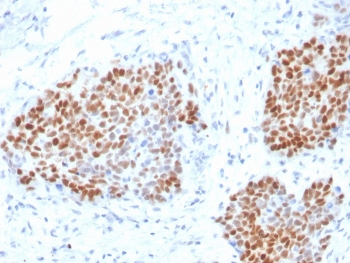Recombinant SOX9 Antibody