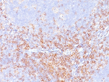 CD4 Antibody