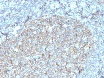 CD81 Antibody