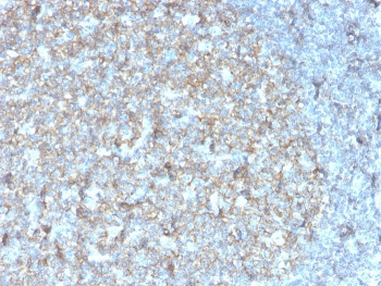 CD81 Antibody