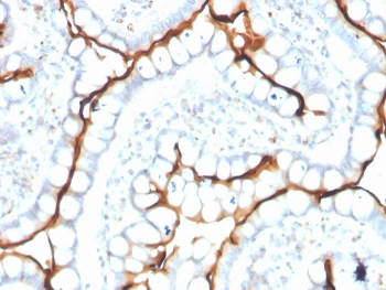 ACE Antibody / Angiotensin I Converting Enzyme