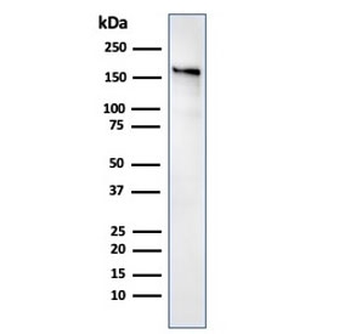 ACE Antibody / Angiotensin I Converting Enzyme