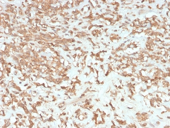Factor VII Antibody