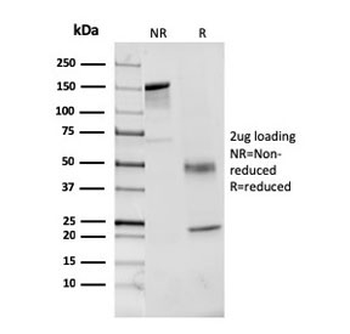Factor VII Antibody