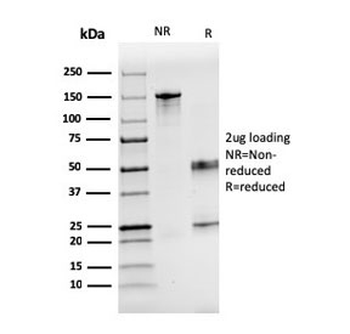Factor VII Antibody