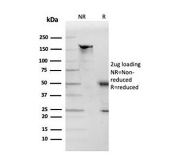 APOD Antibody / Apolipoprotein D