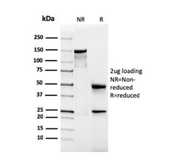 Recombinant Podocalyxin Antibody