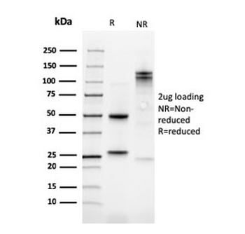 Kindlin-1 Antibody / KIND1