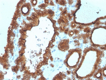 Thyroid Peroxidase Antibody
