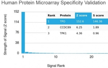 Thyroid Peroxidase Antibody
