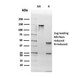 Thyroid Peroxidase Antibody