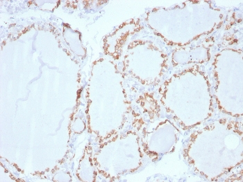 Thyroid Peroxidase Antibody