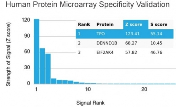 Thyroid Peroxidase Antibody