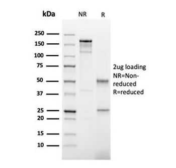 Thyroid Peroxidase Antibody