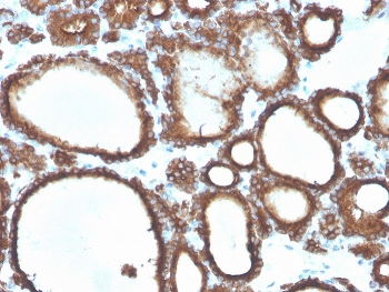 TPO Antibody / Thyroid Peroxidase