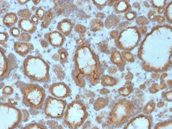 Thyroid Peroxidase Antibody