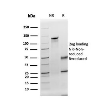 Thyroid Peroxidase Antibody