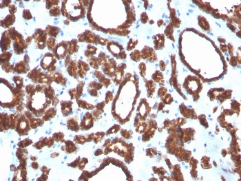 Thyroid Peroxidase Antibody