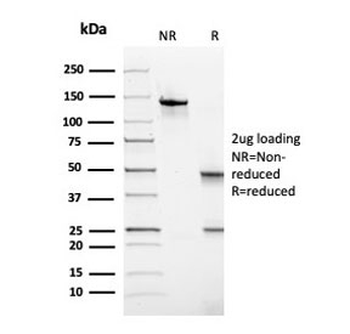 Thyroid Peroxidase Antibody