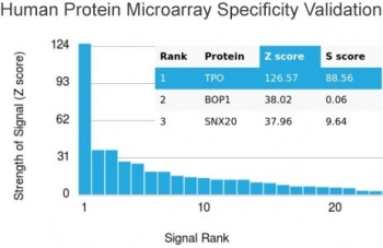 TPO Antibody / Thyroid Peroxidase