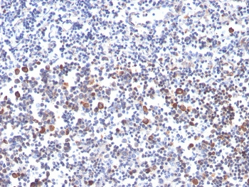 OX40 Antibody / CD134