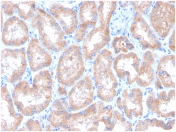 CA9 Antibody / Carbonic Anhydrase IX