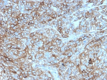PD-L1 Antibody / B7-H1 / CD274