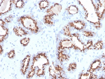 Prostein Antibody / SLC45A3