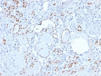 Recombinant PAX8 Antibody