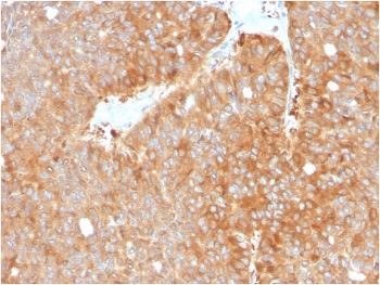 HSP90 beta Antibody / HSP90AB1