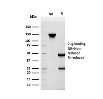 HSP90 beta Antibody / HSP90AB1