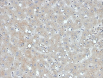 APOB Antibody / Apolipoprotein B