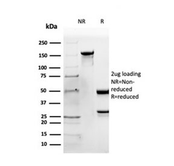 APOB Antibody / Apolipoprotein B
