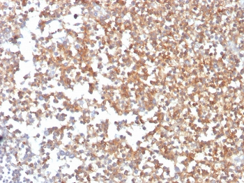 CD10 Antibody / Neprilysin