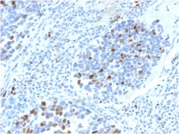 p21 Antibody / CDKN1A