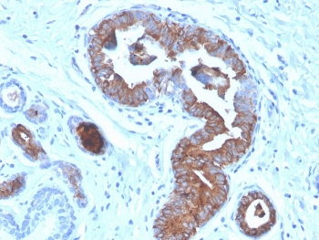 Mammaglobin A Antibody / SCGB2A2
