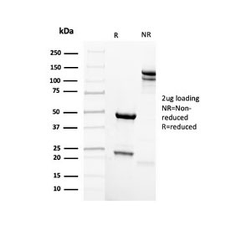 Mammaglobin A Antibody / SCGB2A2
