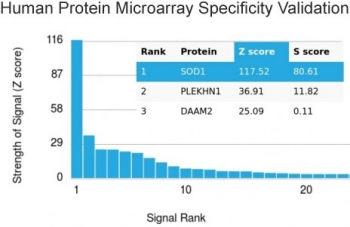 SOD1 Antibody / Superoxide Dismutase 1
