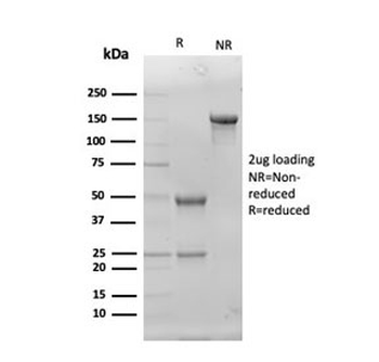 SOD1 Antibody / Superoxide Dismutase 1