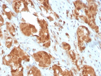 SOD1 Antibody / Superoxide Dismutase 1
