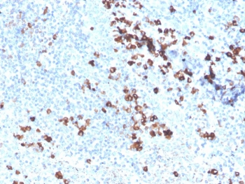 SOD1 Antibody / Superoxide Dismutase 1