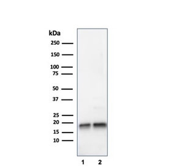 SOD1 Antibody / Superoxide Dismutase 1