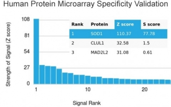 SOD1 Antibody / Superoxide Dismutase 1