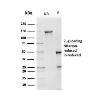 SOD1 Antibody / Superoxide Dismutase 1