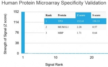 TPO Antibody / Thyroid Peroxidase