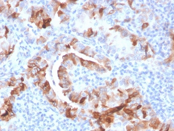 TPO Antibody / Thyroid Peroxidase